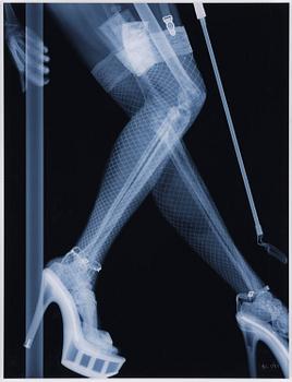 Nick Veasey, "Stripper", 2014.